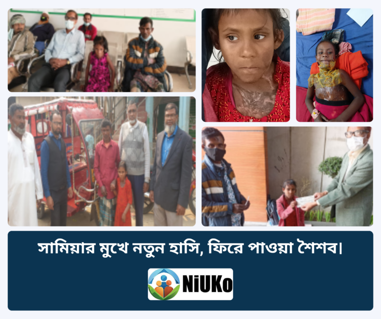 অগ্নিদগ্ধ সামিয়ার চিকিৎসা ও পুনর্বাসন: অবসান হলো একটি পরিবারের দীর্ঘ কষ্টের, পাশে দাঁড়ালো ‘নিউকো’